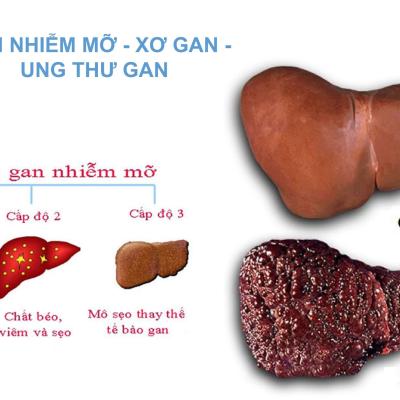 Album tư vấn 6wny 1
